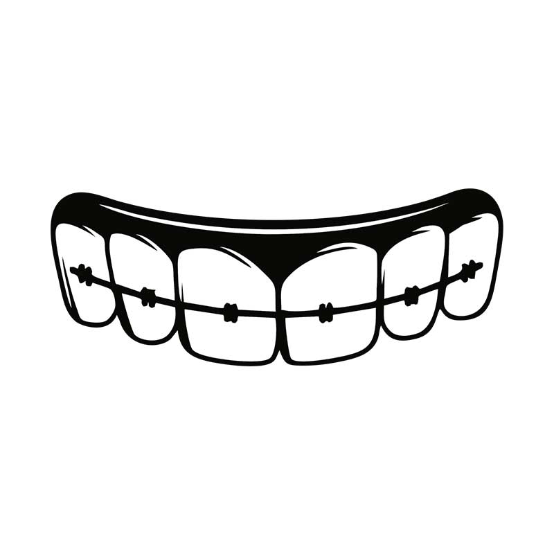 Flat Teeth Braces Silhouette Art